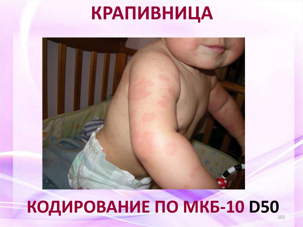 КРАПИВНИЦА