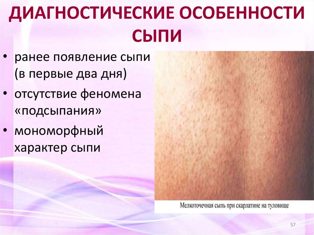 ДИАГНОСТИЧЕСКИЕ ОСОБЕННОСТИ СЫПИ