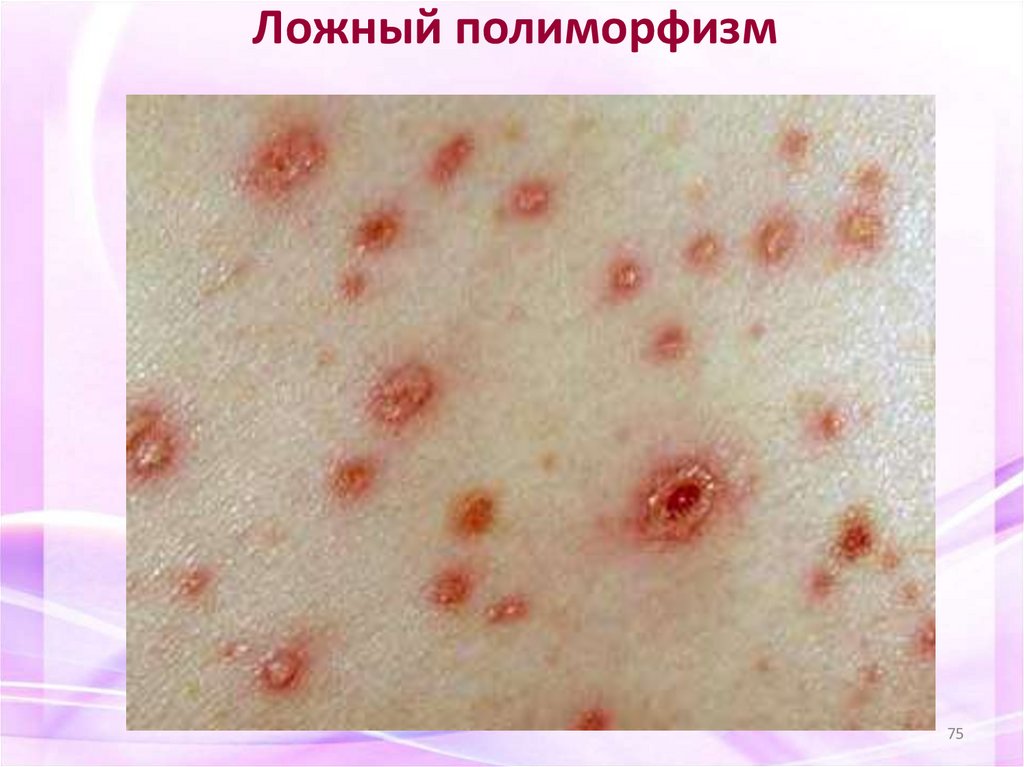 Ложный полиморфизм