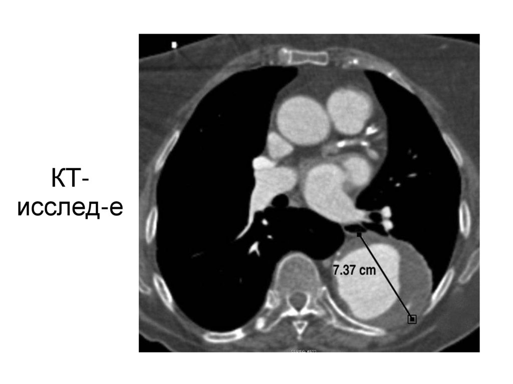КТ-исслед-е