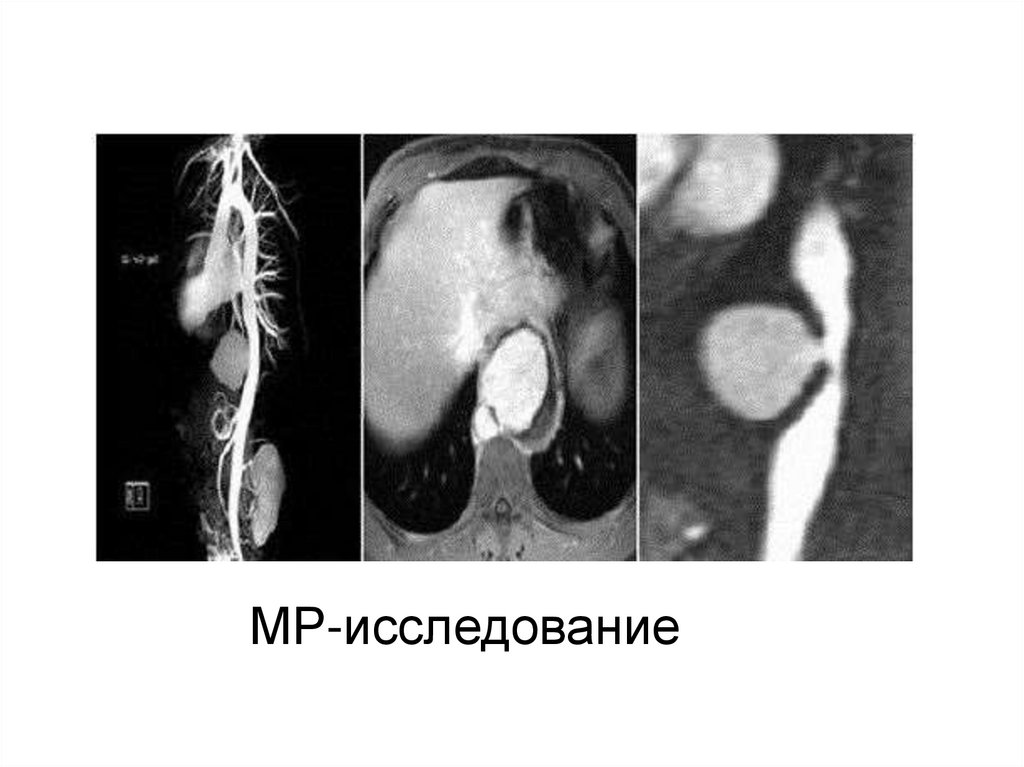 МР-исследование