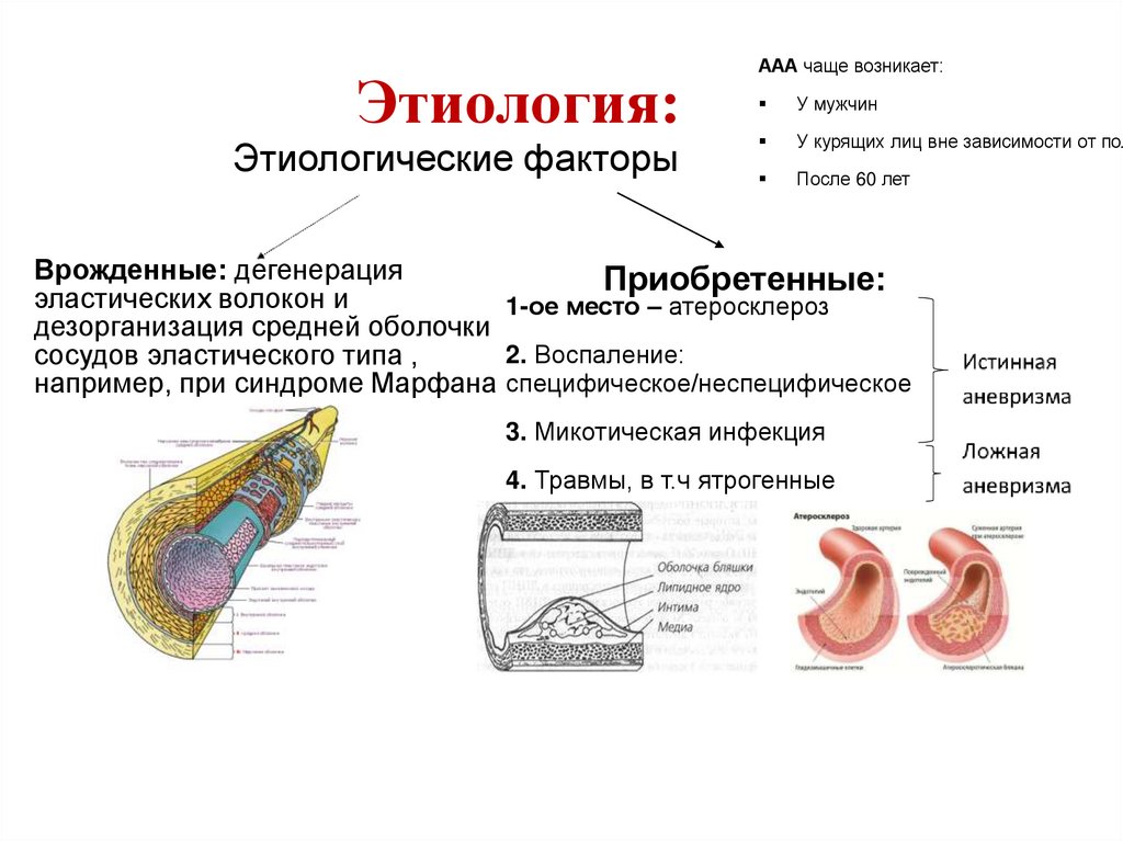 Этиология: Этиологические факторы