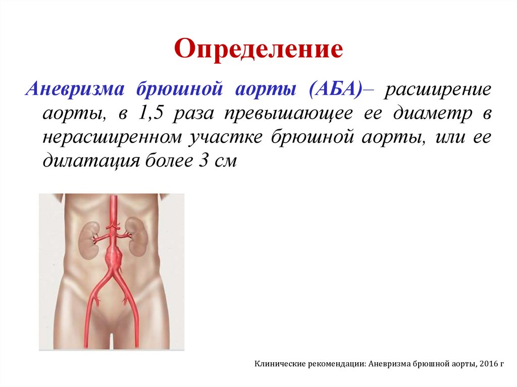 Определение