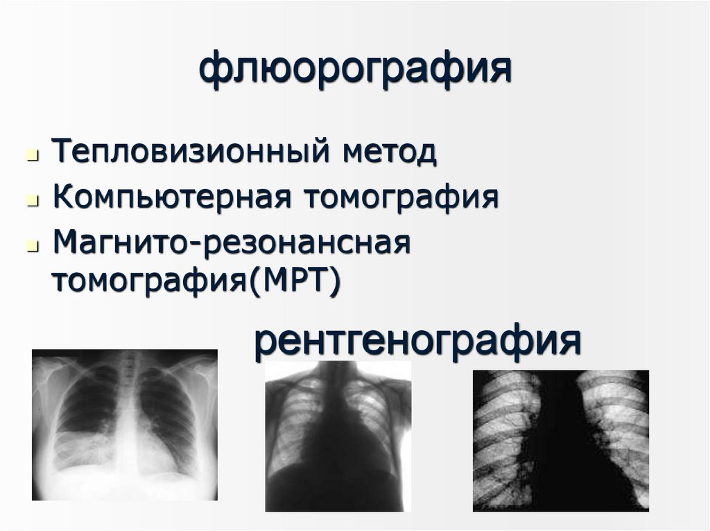 рентгенография