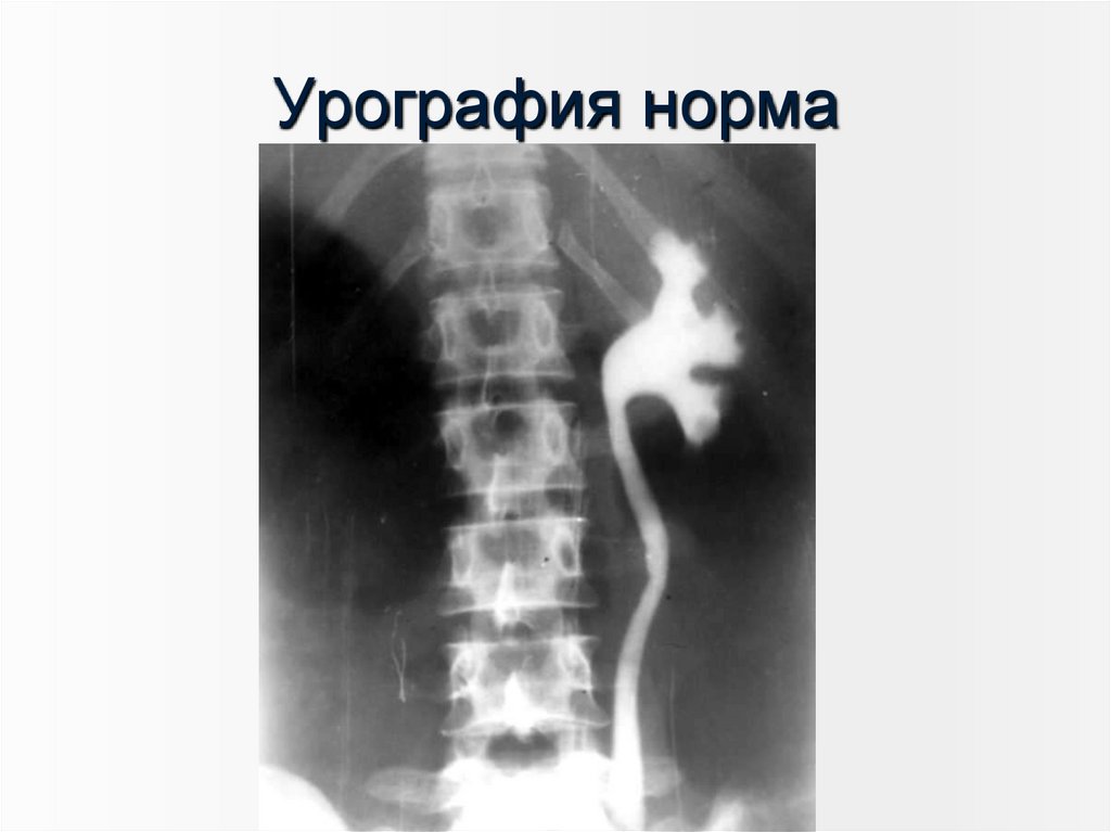 Урография норма