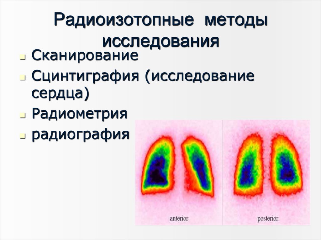 Радиоизотопные методы исследования