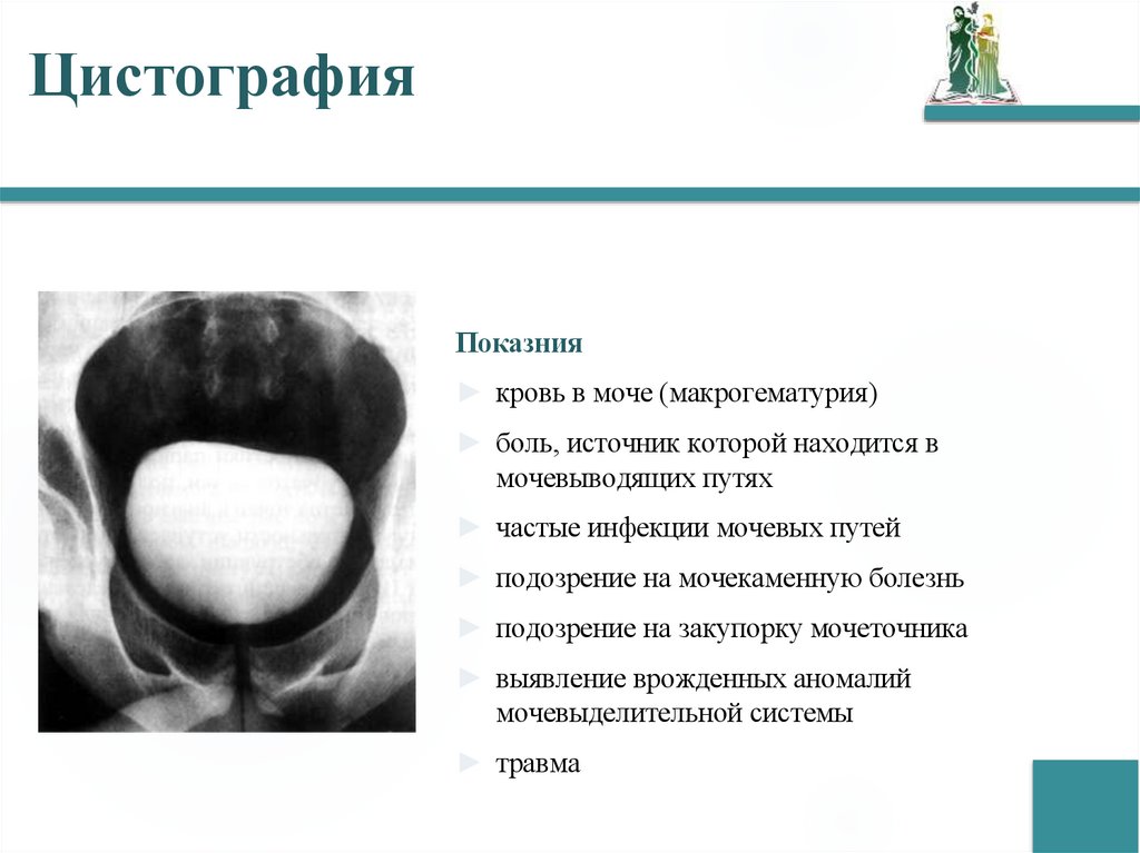 Цистография