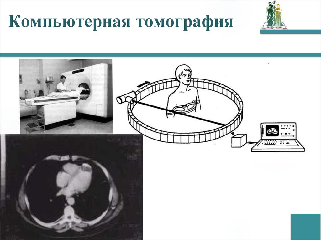 Компьютерная томография