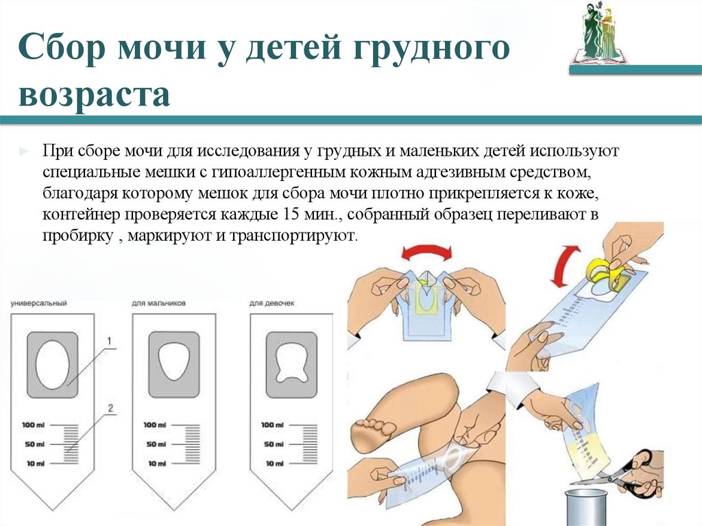 Сбор мочи у детей грудного возраста