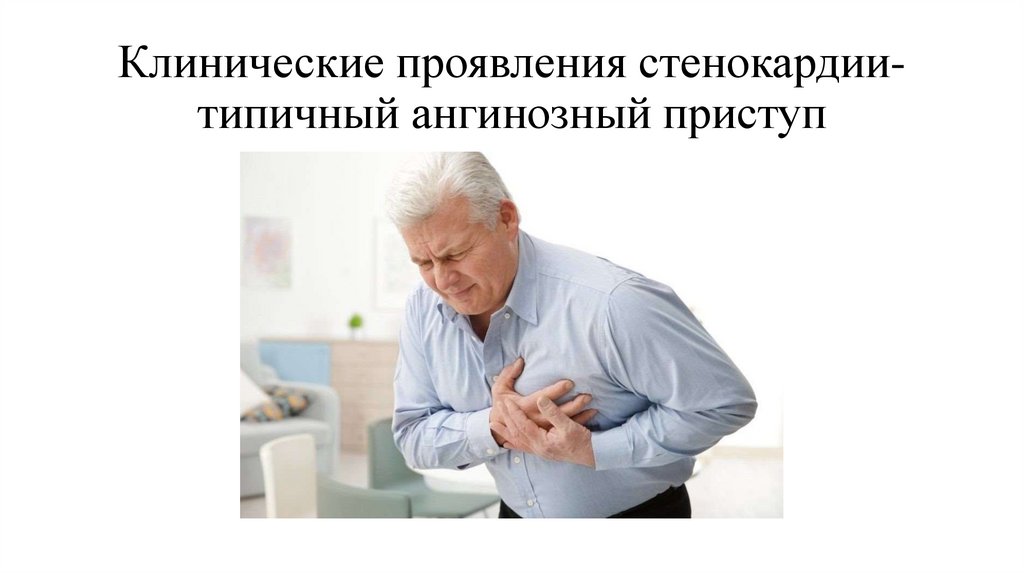 Клинические проявления стенокардии-типичный ангинозный приступ