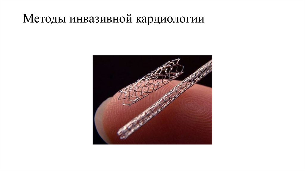 Методы инвазивной кардиологии