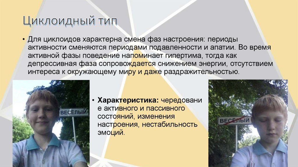 Циклоидный тип