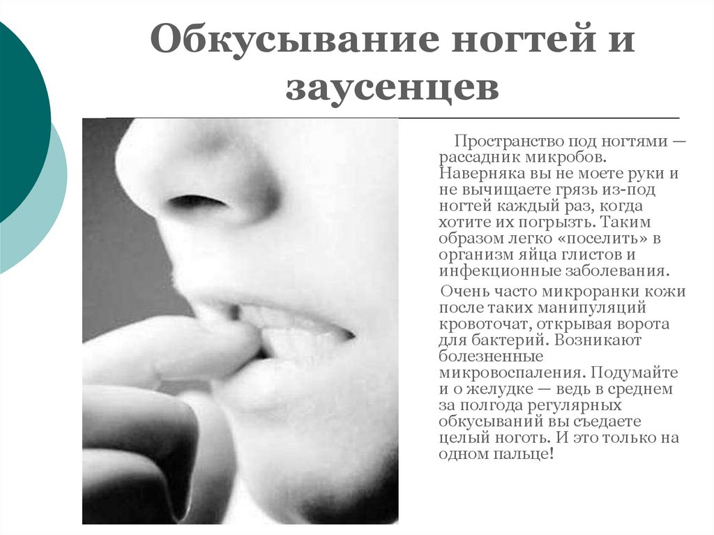 Обкусывание ногтей и заусенцев