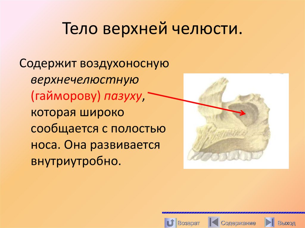 Тело верхней челюсти.