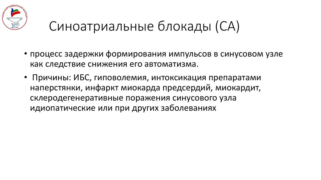 Синоатриальные блокады (СА)
