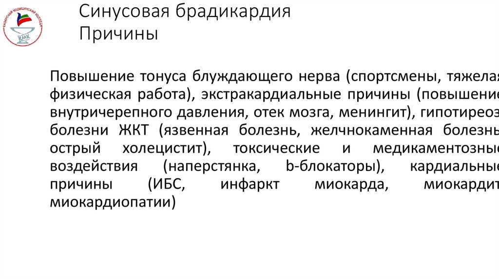 Синусовая брадикардия Причины