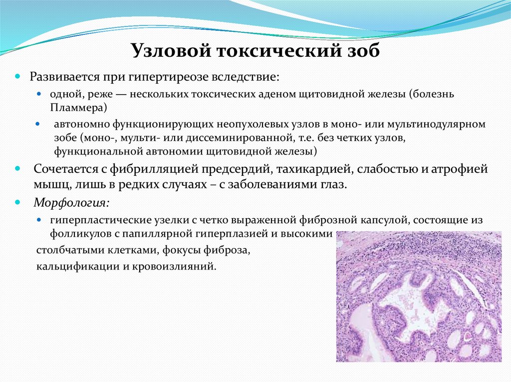 Узловой токсический зоб