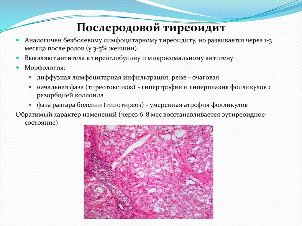 Послеродовой тиреоидит