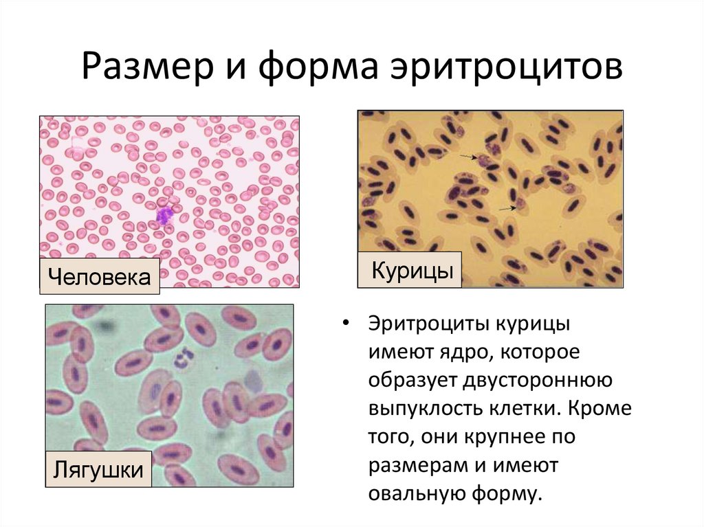 Размер и форма эритроцитов