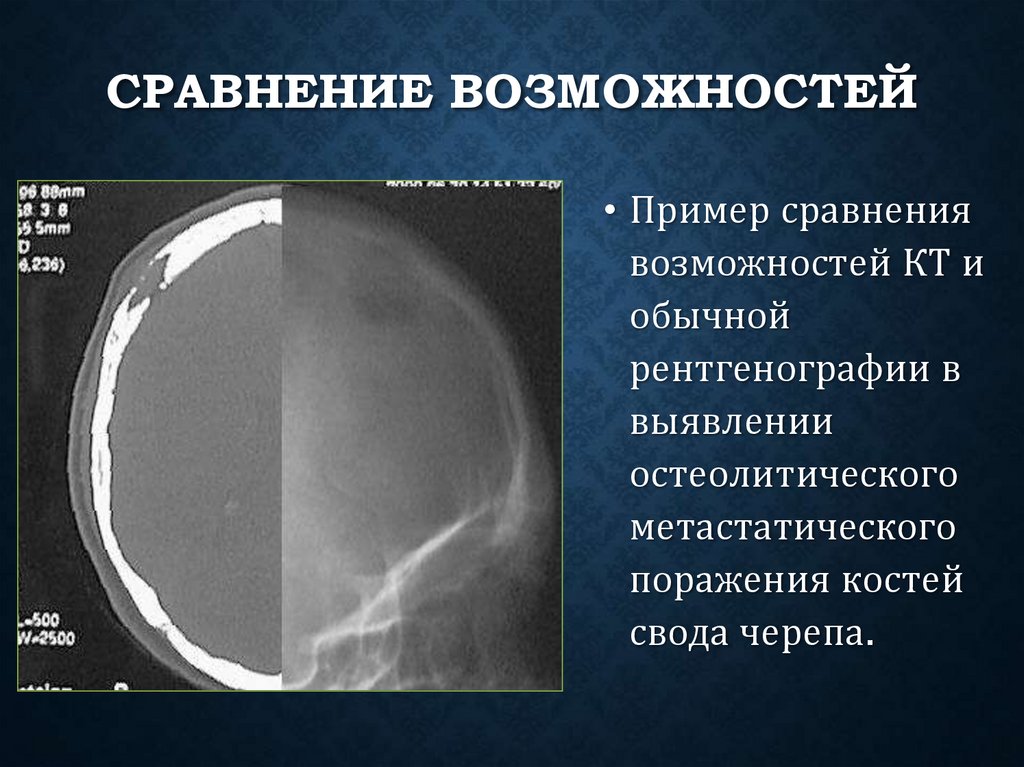 Сравнение возможностей