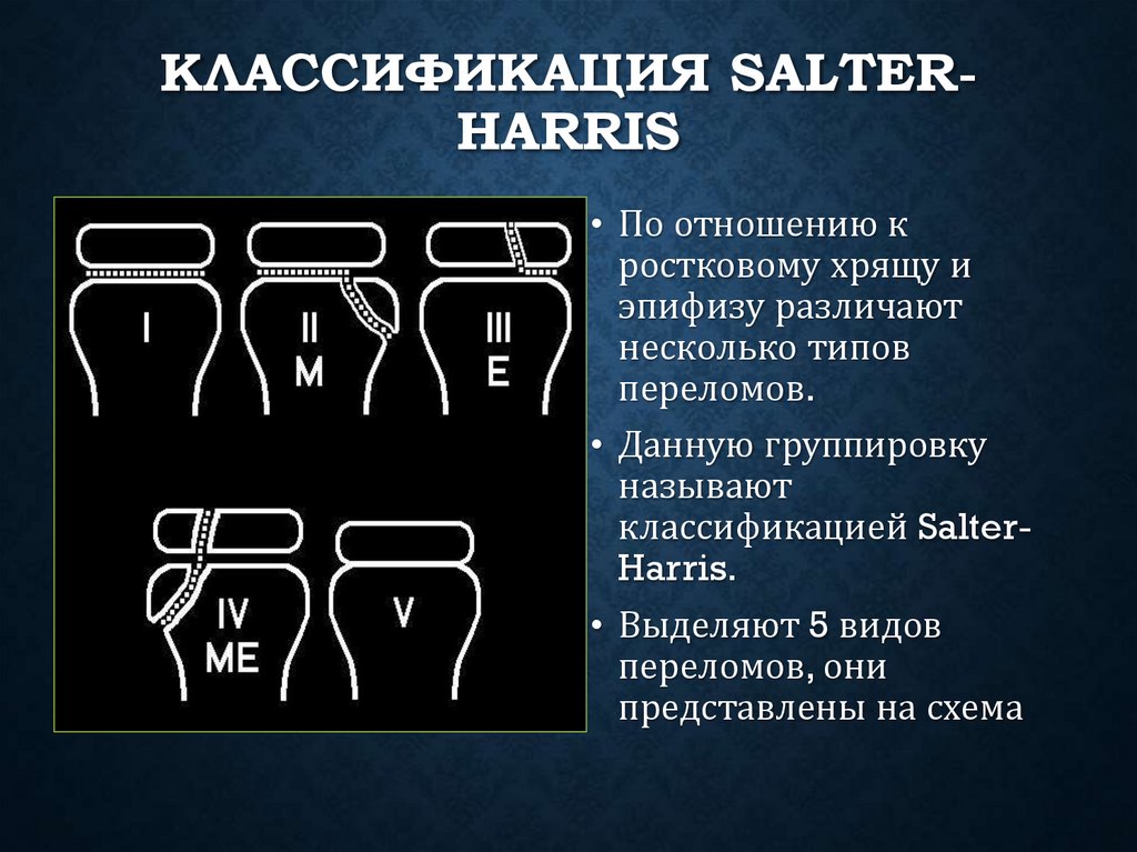 Классификация Salter-Harris