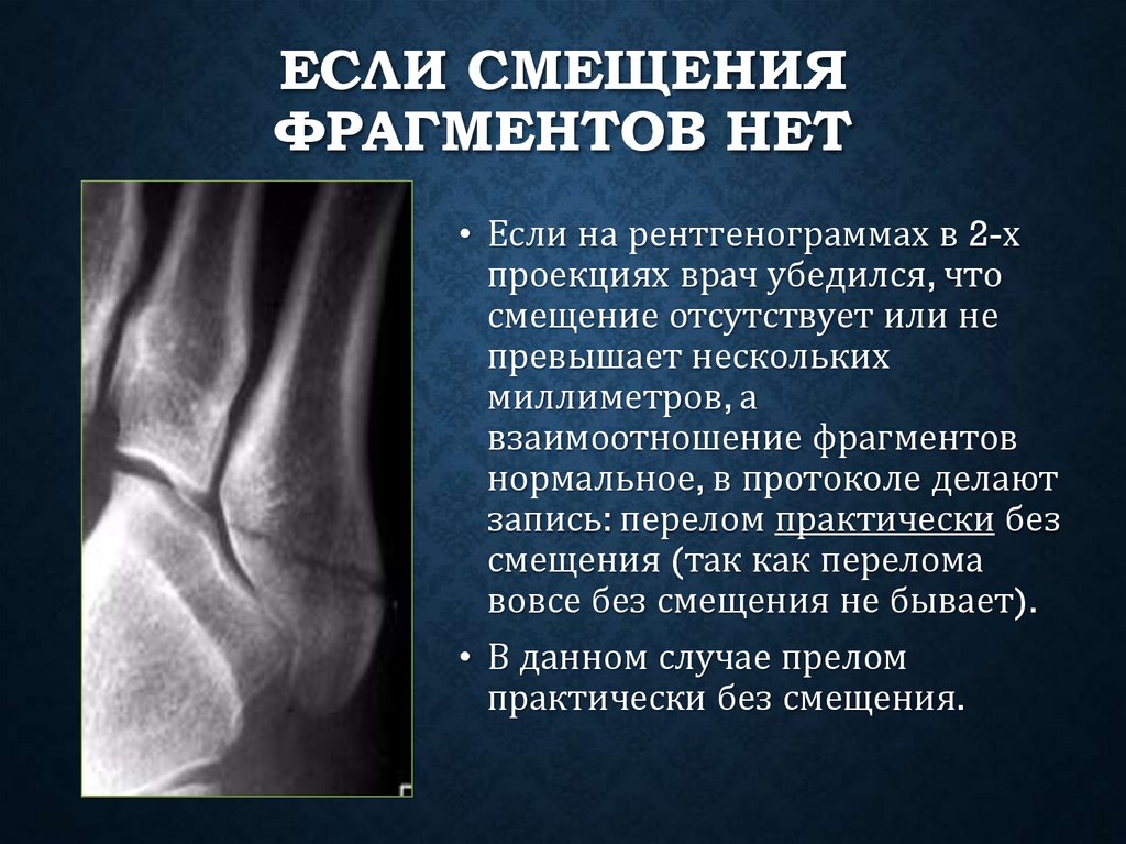 Если смещения фрагментов нет