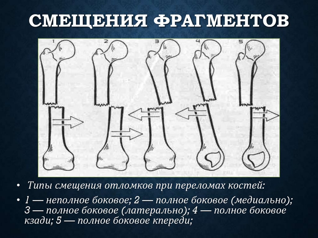 Смещения фрагментов