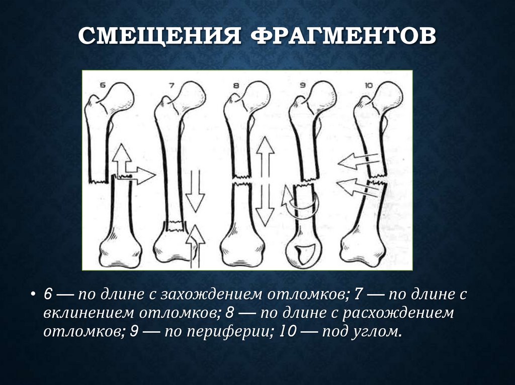 Смещения фрагментов
