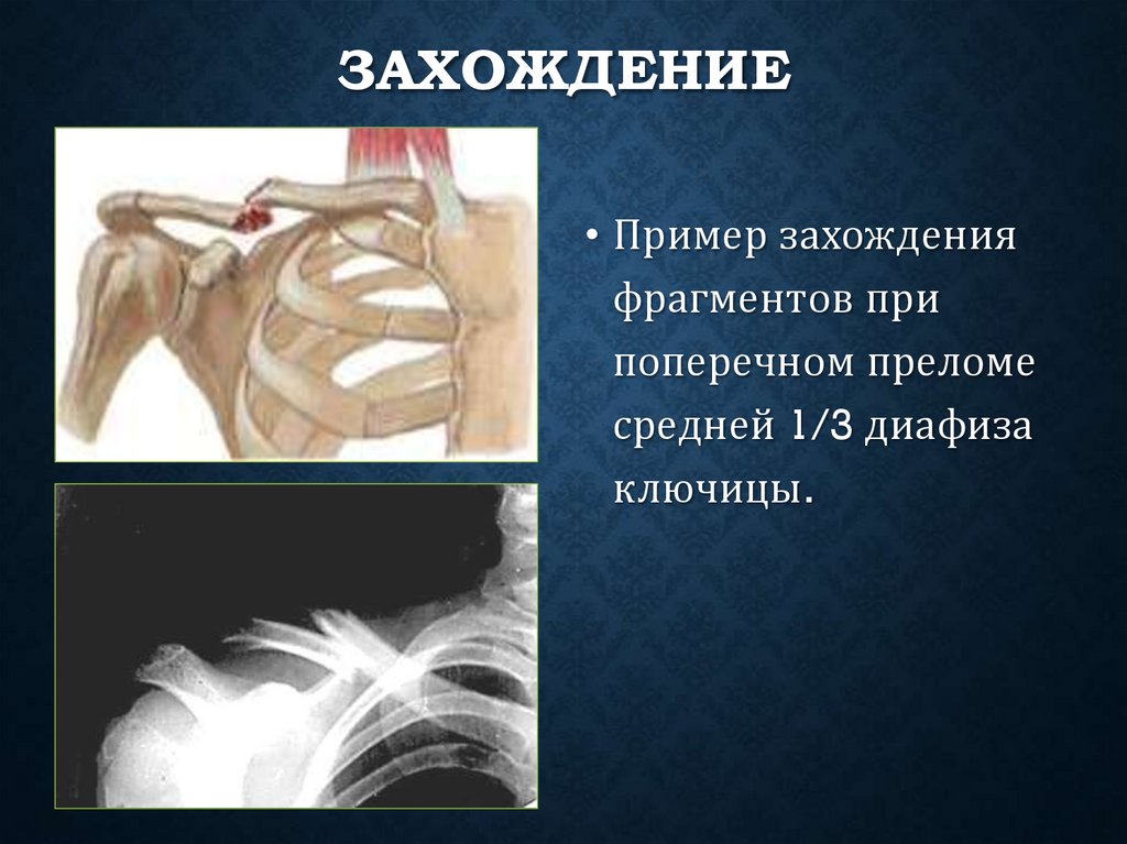 Захождение