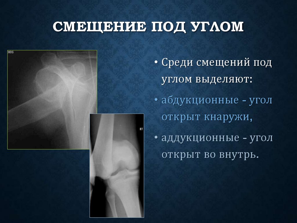 Смещение под углом