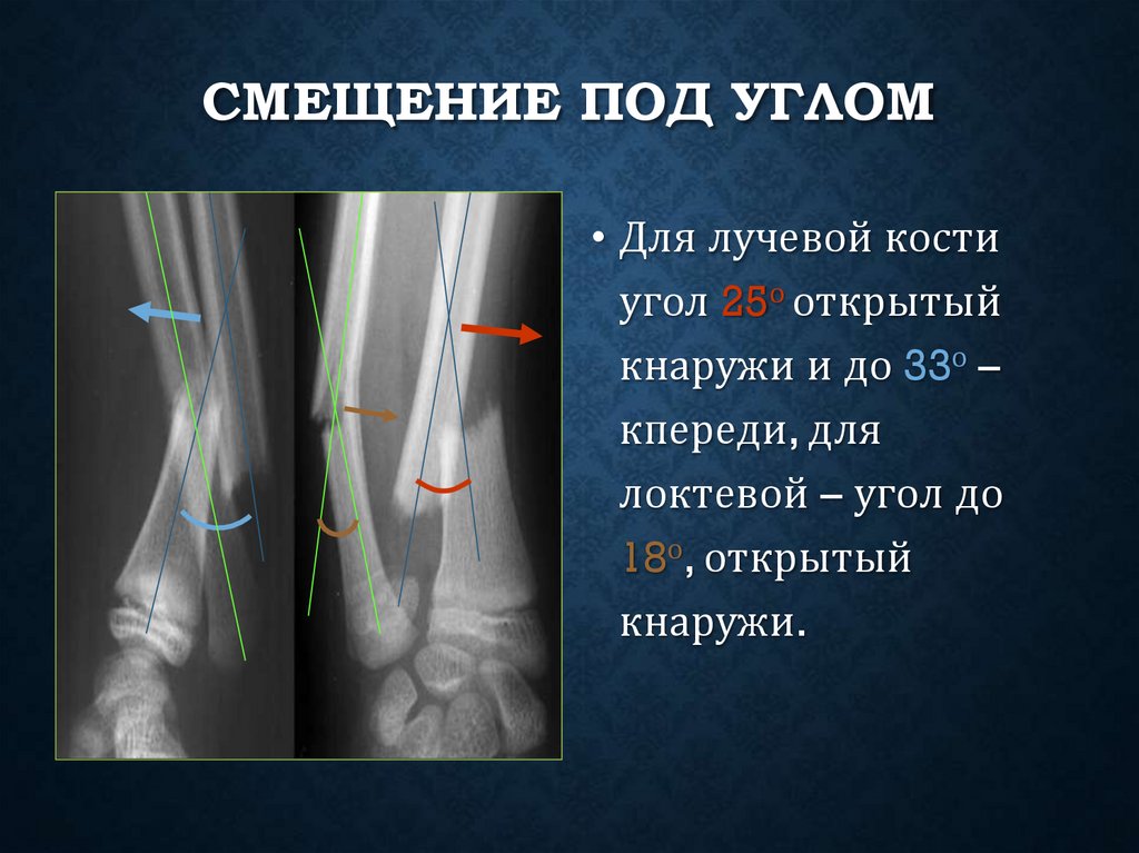 Смещение под углом