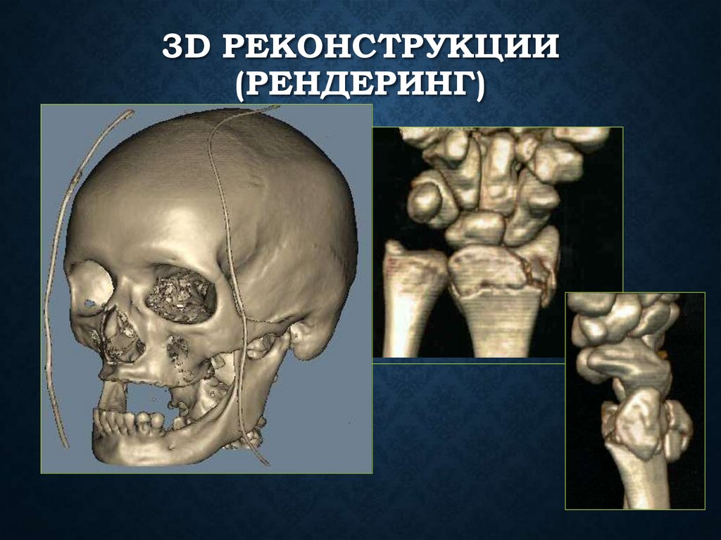3D реконструкции (рендеринг)