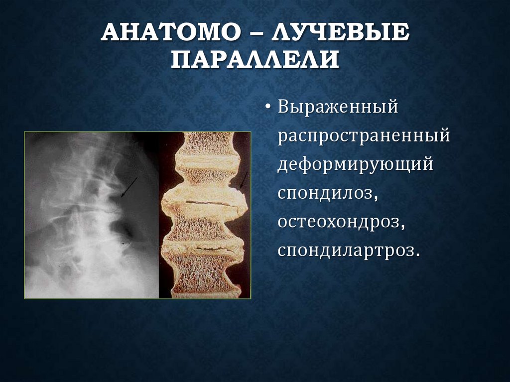 Анатомо – лучевые параллели