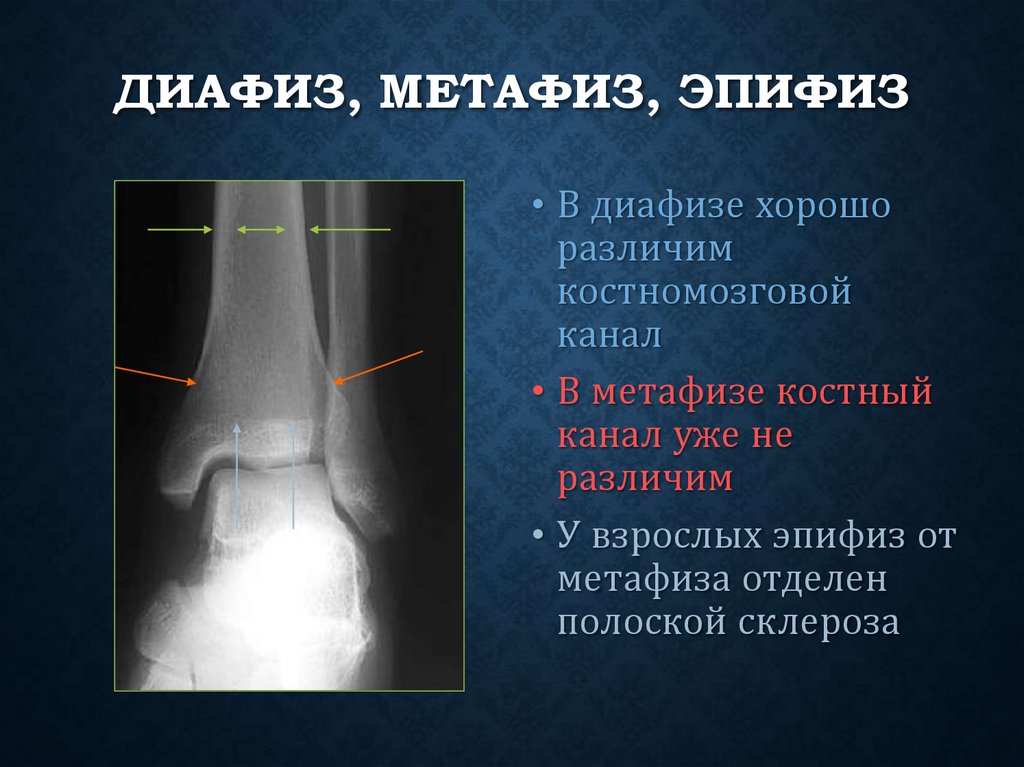 Диафиз, метафиз, эпифиз