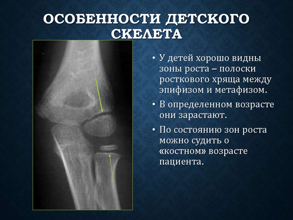 Особенности детского скелета