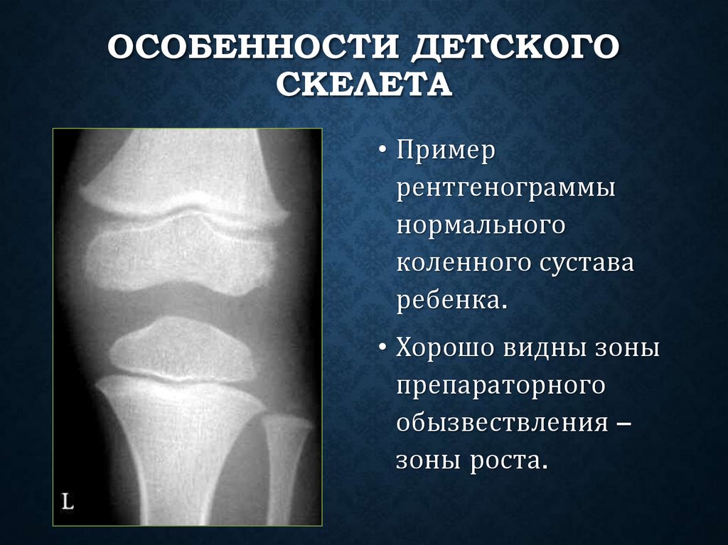 Особенности детского скелета