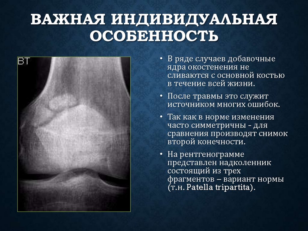 Важная индивидуальная особенность