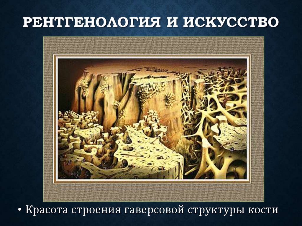 Рентгенология и искусство