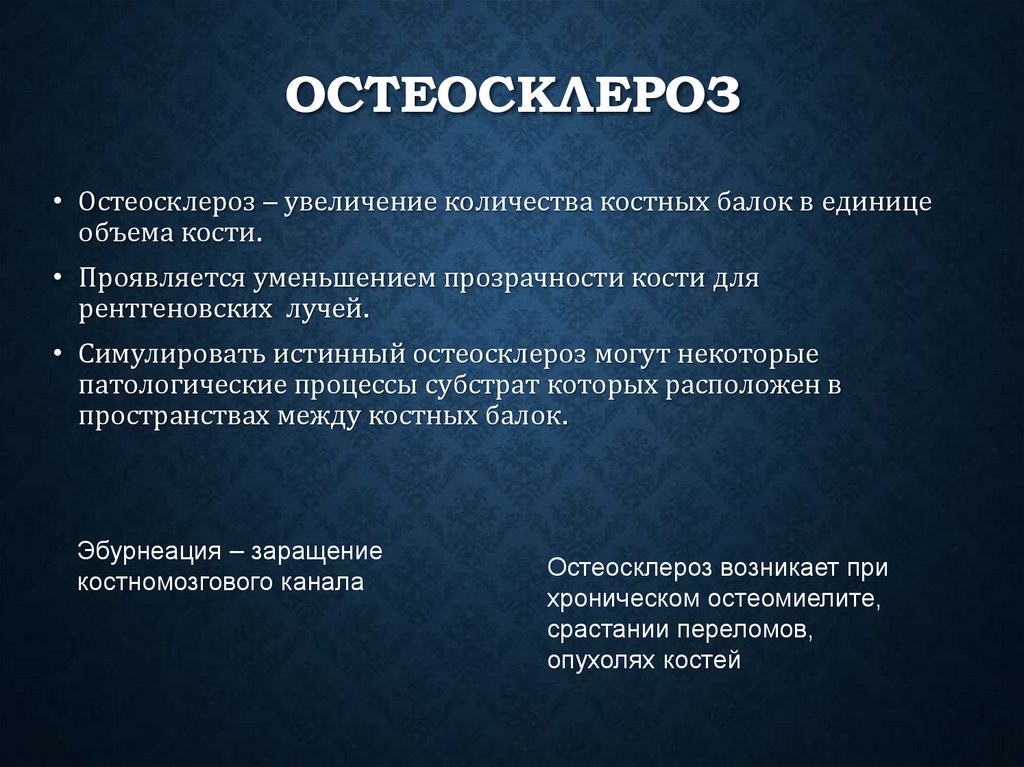 Остеосклероз