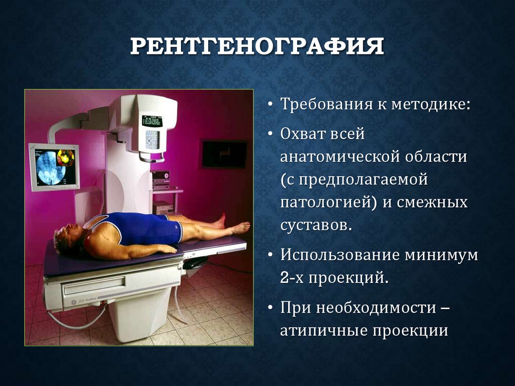 Рентгенография