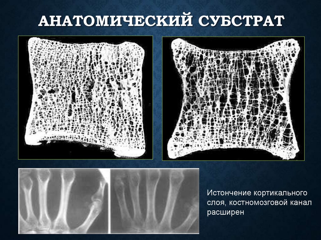 Анатомический субстрат