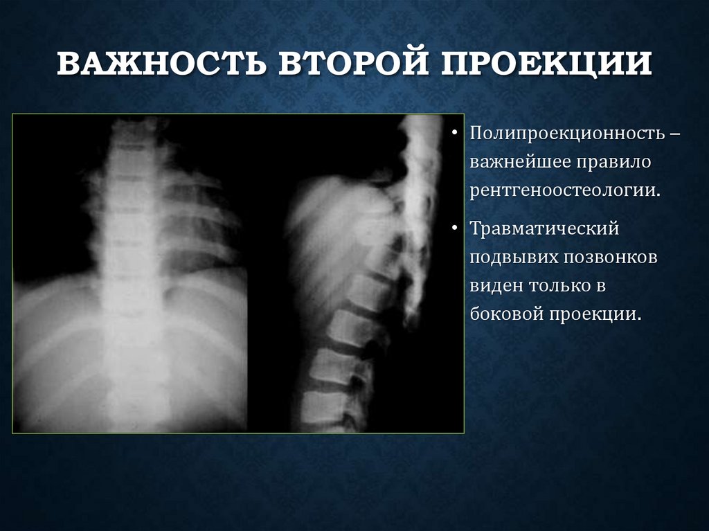 Важность второй проекции