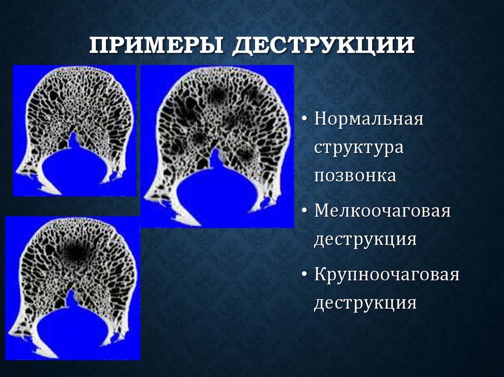 Примеры деструкции