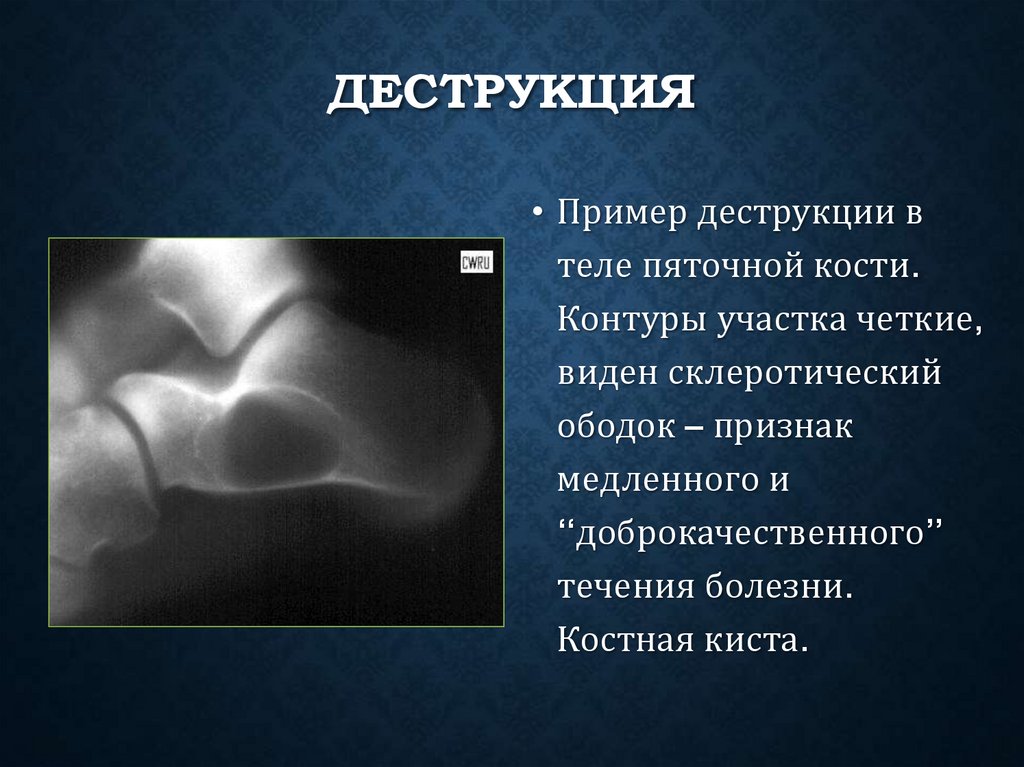Деструкция