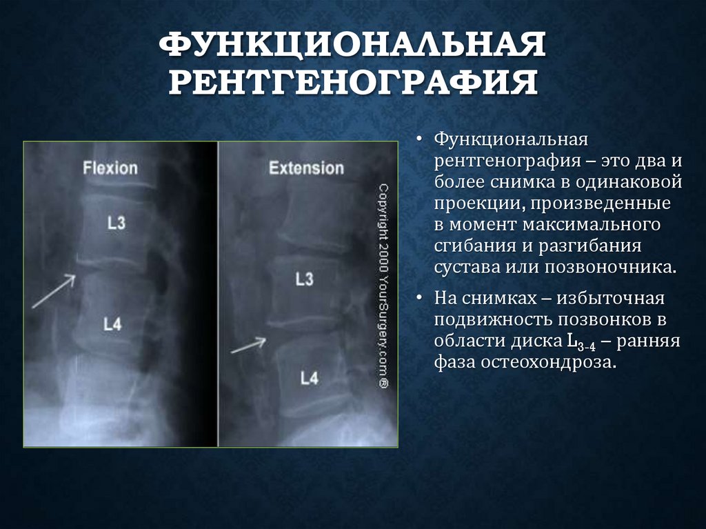 Функциональная рентгенография