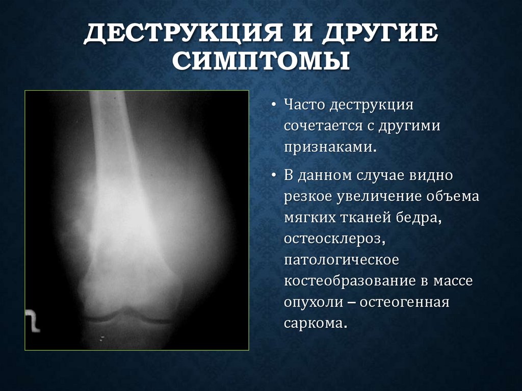 Деструкция и другие симптомы