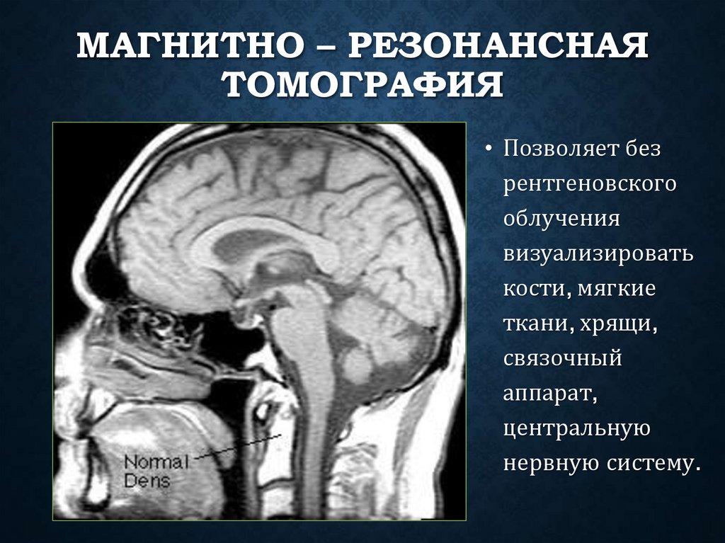 Магнитно – резонансная томография
