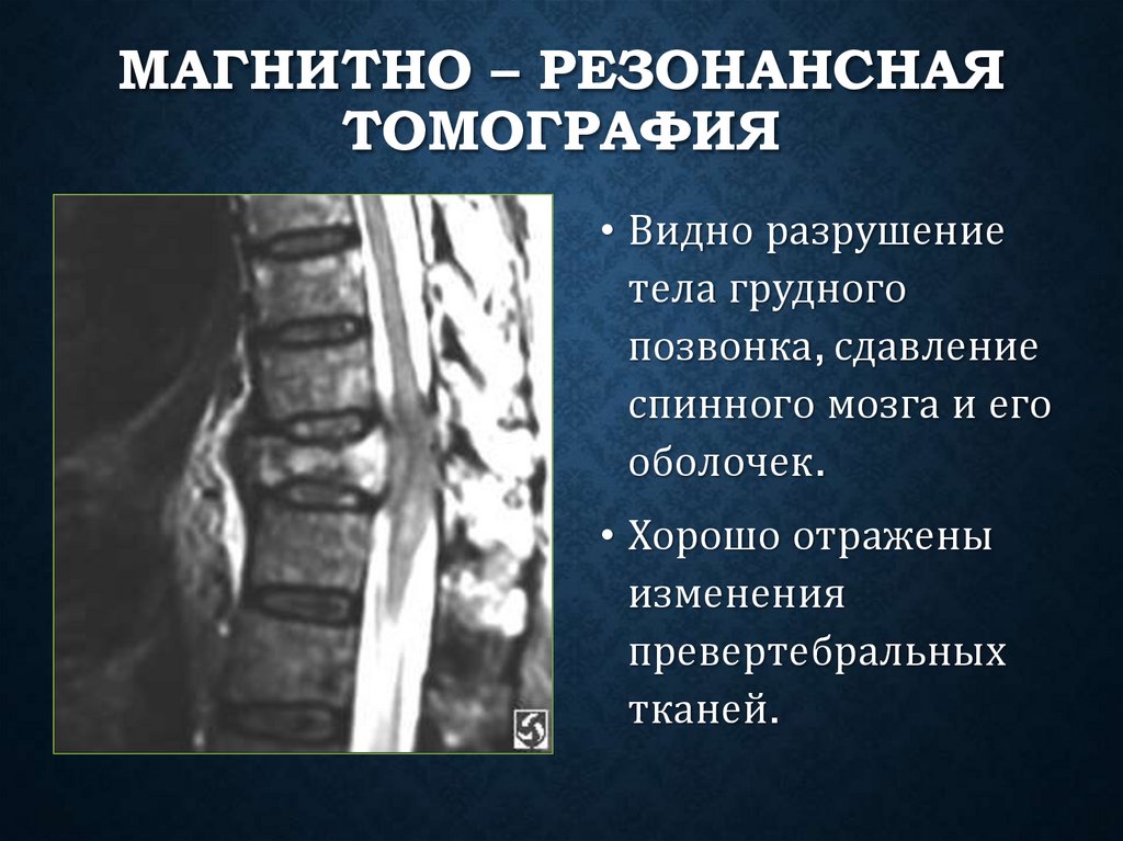 Магнитно – резонансная томография