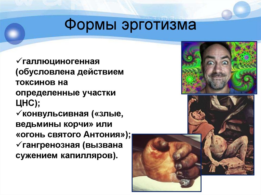 Формы эрготизма