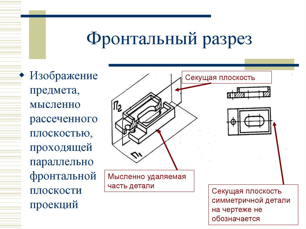Фронтальный разрез